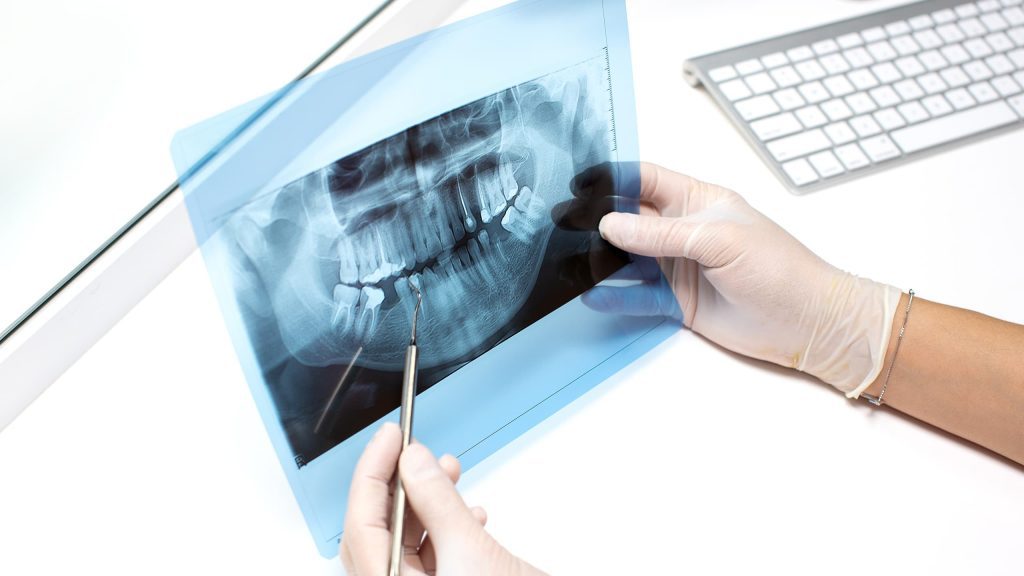 Especialidad Endodoncia